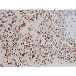 Phospho-ATF2 (Thr69, Thr51) Antibody in Immunohistochemistry (Paraffin) (IHC (P))