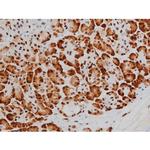 Phospho-ATF2 (Thr69, Thr51) Antibody in Immunohistochemistry (Paraffin) (IHC (P))