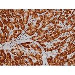 Phospho-ATF2 (Thr69, Thr51) Antibody in Immunohistochemistry (Paraffin) (IHC (P))