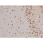 Phospho-ATF2 (Thr69, Thr51) Antibody in Immunohistochemistry (Paraffin) (IHC (P))