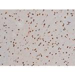 Phospho-ATF2 (Thr69, Thr51) Antibody in Immunohistochemistry (Paraffin) (IHC (P))