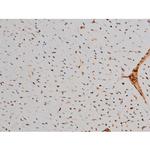 Phospho-ATF2 (Thr69, Thr51) Antibody in Immunohistochemistry (Paraffin) (IHC (P))