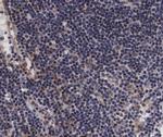 Phospho-VAV1 (Tyr174) Antibody in Immunohistochemistry (Paraffin) (IHC (P))