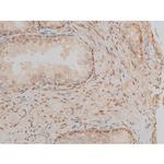 Phospho-CREB (Ser142) Antibody in Immunohistochemistry (Paraffin) (IHC (P))