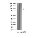 Phospho-PKC Pan (Thr497) Antibody in Western Blot (WB)