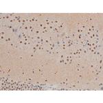 Phospho-JunD (Ser255) Antibody in Immunohistochemistry (Paraffin) (IHC (P))