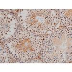 Phospho-JunD (Ser255) Antibody in Immunohistochemistry (Paraffin) (IHC (P))