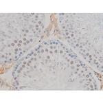 Phospho-JunD (Ser255) Antibody in Immunohistochemistry (Paraffin) (IHC (P))