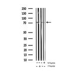 Phospho-Synapsin 1 (Ser9) Antibody in Western Blot (WB)