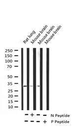 Phospho-C/EBP beta (Thr235, Thr188) Antibody in Western Blot (WB)