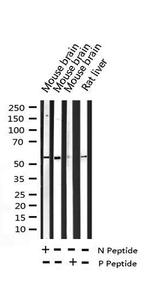 Phospho-GABRB1 (Ser434) Antibody in Western Blot (WB)