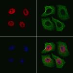 Phospho-Elk1 (Ser383) Antibody in Immunocytochemistry (ICC/IF)