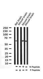 Phospho-Elk1 (Ser389) Antibody in Western Blot (WB)