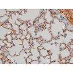 Phospho-Filamin A (Ser2152) Antibody in Immunohistochemistry (Paraffin) (IHC (P))