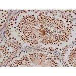 Phospho-Filamin A (Ser2152) Antibody in Immunohistochemistry (Paraffin) (IHC (P))