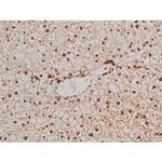 Phospho-Filamin A (Ser2152) Antibody in Immunohistochemistry (Paraffin) (IHC (P))