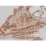 Phospho-Filamin A (Ser2152) Antibody in Immunohistochemistry (Paraffin) (IHC (P))