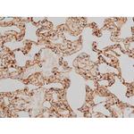 Phospho-Filamin A (Ser2152) Antibody in Immunohistochemistry (Paraffin) (IHC (P))