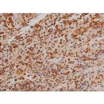 Phospho-Filamin A (Ser2152) Antibody in Immunohistochemistry (Paraffin) (IHC (P))