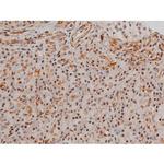 Phospho-Filamin A (Ser2152) Antibody in Immunohistochemistry (Paraffin) (IHC (P))