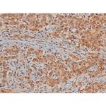 Phospho-Filamin A (Ser2152) Antibody in Immunohistochemistry (Paraffin) (IHC (P))