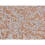 Phospho-Filamin A (Ser2152) Antibody in Immunohistochemistry (Paraffin) (IHC (P))