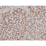 Phospho-Filamin A (Ser2152) Antibody in Immunohistochemistry (Paraffin) (IHC (P))