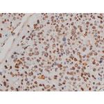 Phospho-Filamin A (Ser2152) Antibody in Immunohistochemistry (Paraffin) (IHC (P))