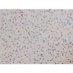 Phospho-Filamin A (Ser2152) Antibody in Immunohistochemistry (Paraffin) (IHC (P))