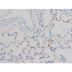 Phospho-p70 S6 Kinase (Ser371) Antibody in Immunohistochemistry (Paraffin) (IHC (P))