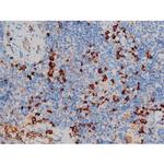 Phospho-p70 S6 Kinase (Ser371) Antibody in Immunohistochemistry (Paraffin) (IHC (P))