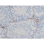 Phospho-p70 S6 Kinase (Ser371) Antibody in Immunohistochemistry (Paraffin) (IHC (P))