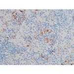 Phospho-p70 S6 Kinase (Ser371) Antibody in Immunohistochemistry (Paraffin) (IHC (P))