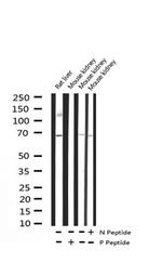 Phospho-p70 S6 Kinase (Ser371) Antibody in Western Blot (WB)