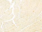 Phospho-p70 S6 Kinase (Thr389, Thr412) Antibody in Immunohistochemistry (Paraffin) (IHC (P))