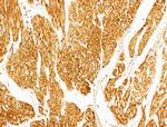 Phospho-p70 S6 Kinase (Thr389, Thr412) Antibody in Immunohistochemistry (Paraffin) (IHC (P))