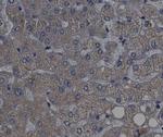 Phospho-p70 S6 Kinase (Thr389, Thr412) Antibody in Immunohistochemistry (Paraffin) (IHC (P))