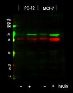 Phospho-p70 S6 Kinase (Thr389, Thr412) Antibody in Western Blot (WB)