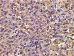 Phospho-PI3K p85 alpha (Tyr607) Antibody in Immunohistochemistry (Paraffin) (IHC (P))