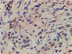 Phospho-PI3K p85 alpha (Tyr607) Antibody in Immunohistochemistry (Paraffin) (IHC (P))