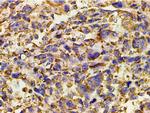 Phospho-PI3K p85 alpha (Tyr607) Antibody in Immunohistochemistry (Paraffin) (IHC (P))