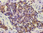 Phospho-PI3K p85 alpha (Tyr607) Antibody in Immunohistochemistry (Paraffin) (IHC (P))