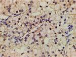 Phospho-PI3K p85 alpha (Tyr607) Antibody in Immunohistochemistry (Paraffin) (IHC (P))