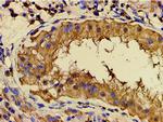 Phospho-PI3K p85 alpha (Tyr607) Antibody in Immunohistochemistry (Paraffin) (IHC (P))