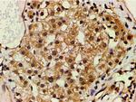 Phospho-PI3K p85 alpha (Tyr607) Antibody in Immunohistochemistry (Paraffin) (IHC (P))