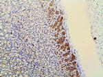 Phospho-PI3K p85 alpha (Tyr607) Antibody in Immunohistochemistry (Paraffin) (IHC (P))