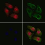 Phospho-Cdc25A (Ser178) Antibody in Immunocytochemistry (ICC/IF)