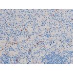 Phospho-Cdc25A (Ser178) Antibody in Immunohistochemistry (Paraffin) (IHC (P))