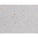 Phospho-Cdc25A (Ser178) Antibody in Immunohistochemistry (Paraffin) (IHC (P))