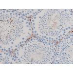 Phospho-CDC25B (Ser323) Antibody in Immunohistochemistry (Paraffin) (IHC (P))